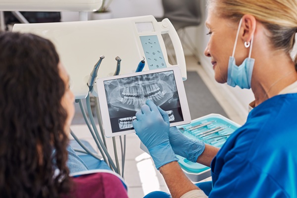 What To Expect From A Root Canal By An Emergency Dentist